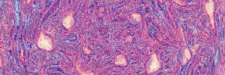 Cross section of a red cabbage